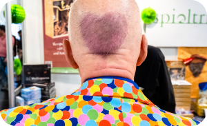 Head from the back with hair in heart form